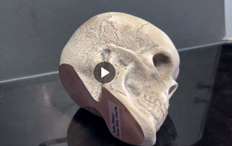 photo of skull